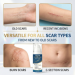 Silicone Scar Care Cream - 图片 3