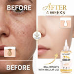 Glycolic Acid Exfoliating Toner - 图片 3