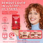 Teeth Whitening Strips - 图片 2