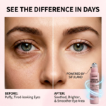 Cooling Eye Roller - 图片 2